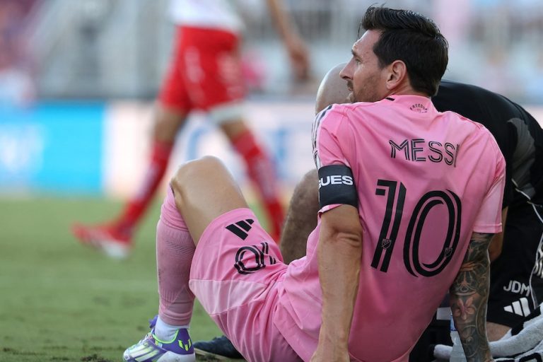 Inter Miami revela la gravedad de la lesión de Lionel Messi y el tiempo que estará ausente tras el partido contra Necaxa