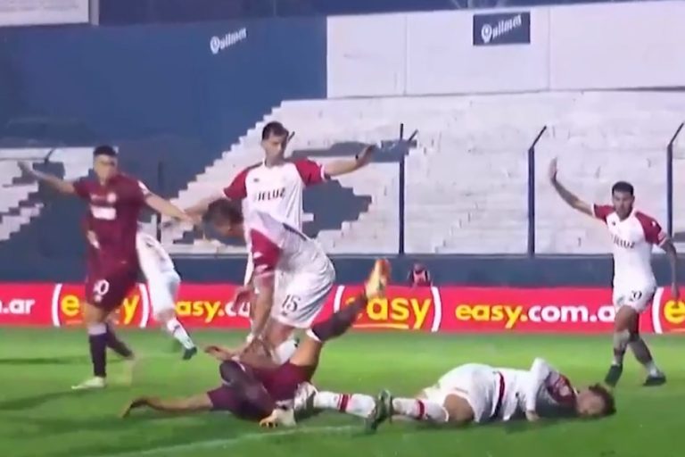 Defensor de Lanús, Ronaldo Dejesús, será operado tras fractura en el cráneo por choque con Luciano Giménez